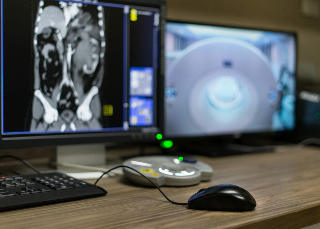 As Subspecialization in Radiology Rises