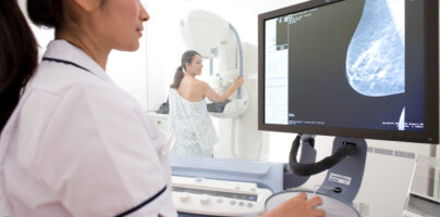 Decreased Mammography in Breast Cancer Survivors