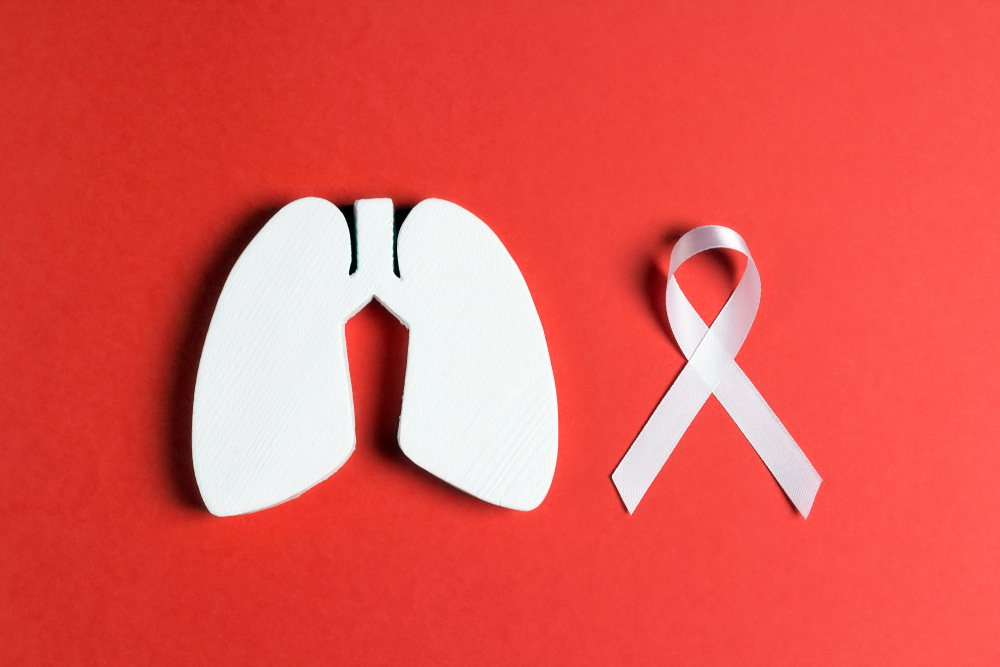 Early Stage Lung Cancer Has 80% Survival Rate over 20 years