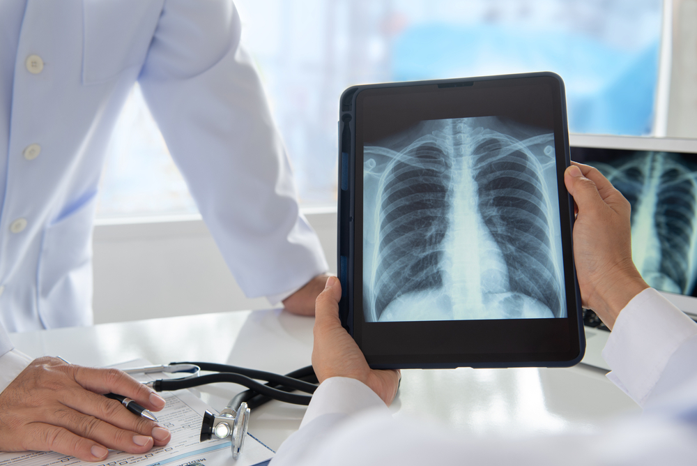 Ten Trends in Thoracic Radiology That Point to the Future